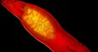 Scientists grow human livers in lab