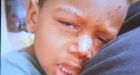Brooklyn Mother Says Rat Bit Young Son While He Slept