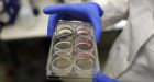 UBC scientists say a gene found in every human cell could be a cause of obesity